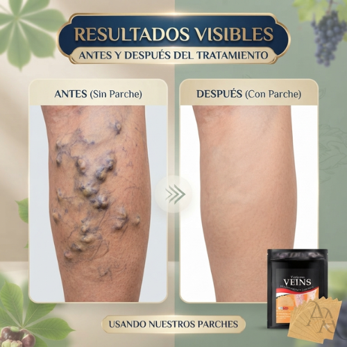 Pack 24 Parches Para Varices